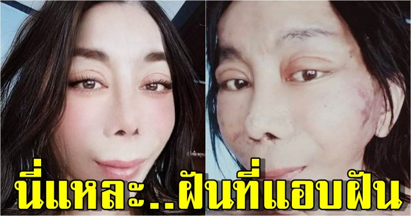 สิตางศุ์ บัวทอง โชว์ภาพ Before-After กับหน้าใหม่ที่อยากได้